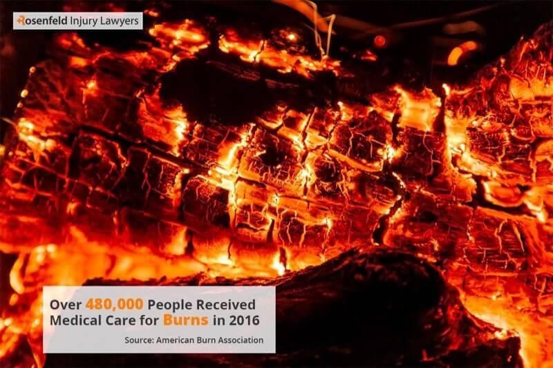 Chicago Burn Injury Lawyer