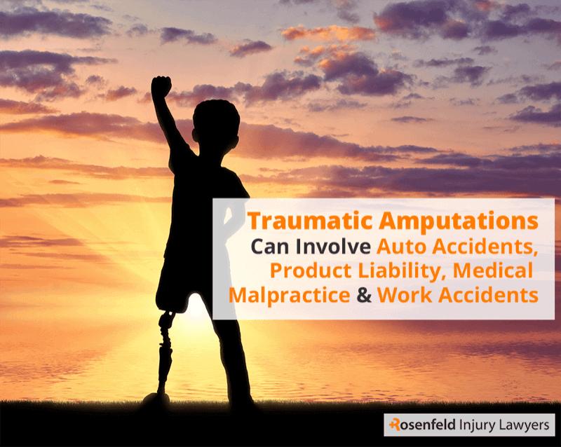Chicago Illinois amputation attorney