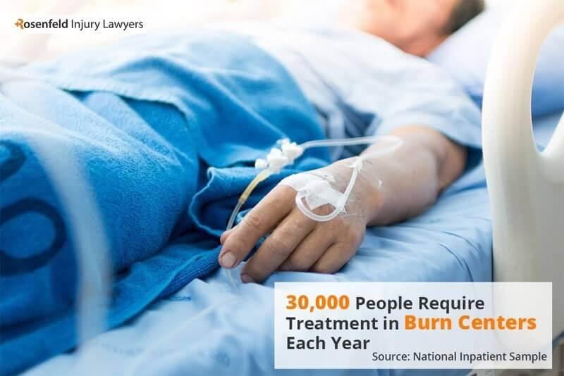 Burn Injury Lawyer