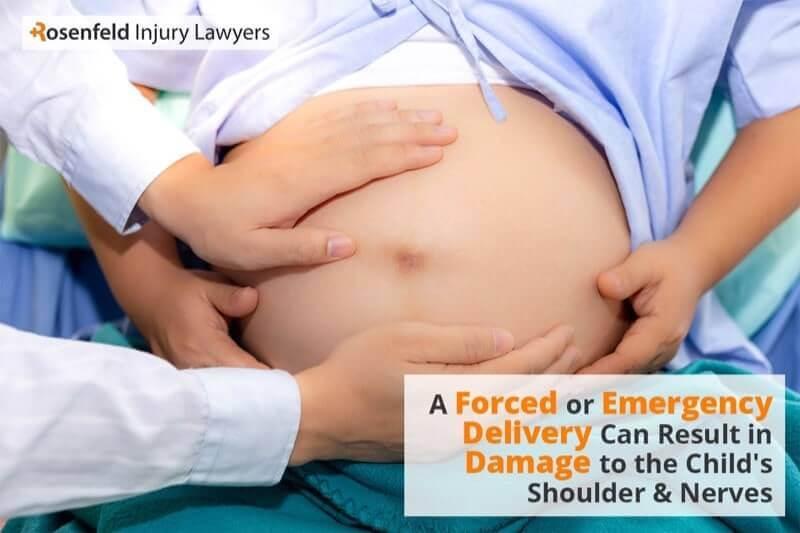 Chicago erb's palsy lawyer for brachial plexus injuries