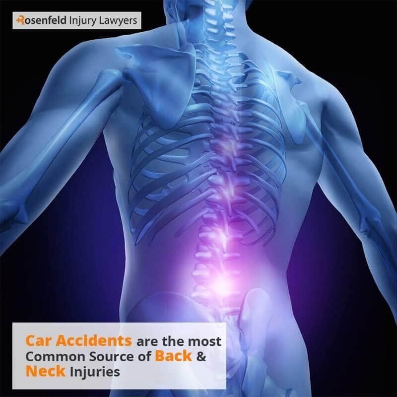Chicago Back Neck Injury Lawyer 