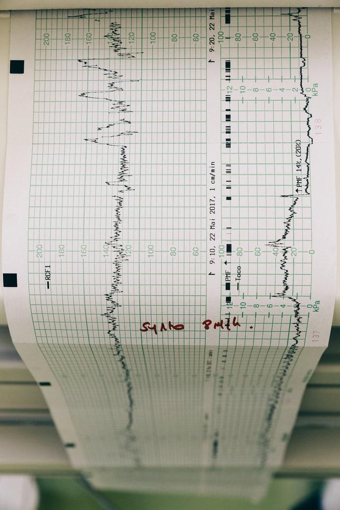 Attorney reviewing medical records for a potential birth injury lawsuit.