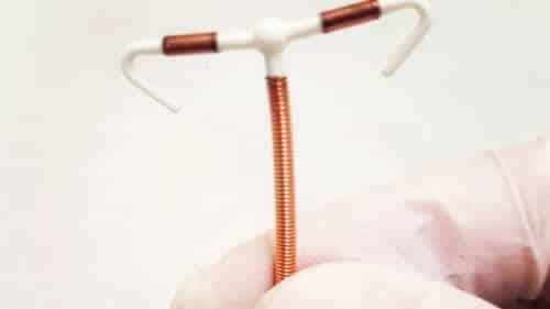 Paragard is a copper IUD
 
