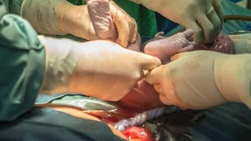 Cerebral Palsy Elgin